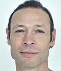 Hugo Dillon